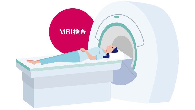 MRI検査のイメージ図。